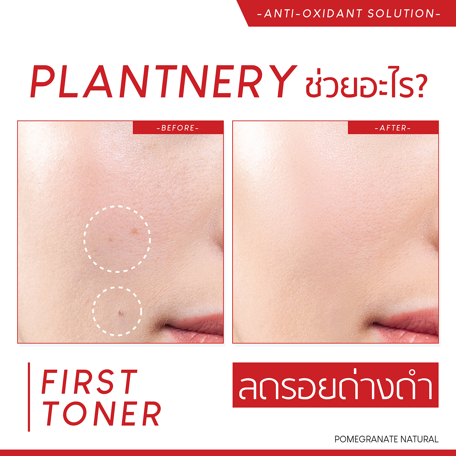 Plantnery Pomegranate First Toner 250ml โทนเนอร์ทับทิม ลดรอยดำรอยแดงจากสิว 