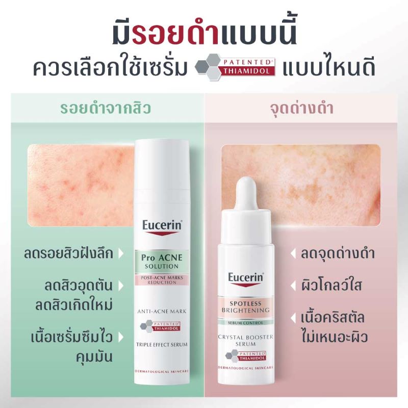 EUCERIN Spotless Brightening Sebum Control Crystal Booster Serum 30ml ,EUCERIN ยูเซอริน สปอตเลส ไบรท์เทนนิ่ง ซีบัม คอนโทรล คริสตัล บูสเตอร์ เซรั่ม , EUCERIN , ยูเซอริน , EUCERIN เซรั่ม  , EUCERIN ฝ้า , EUCERIN จุดด่างดำ
