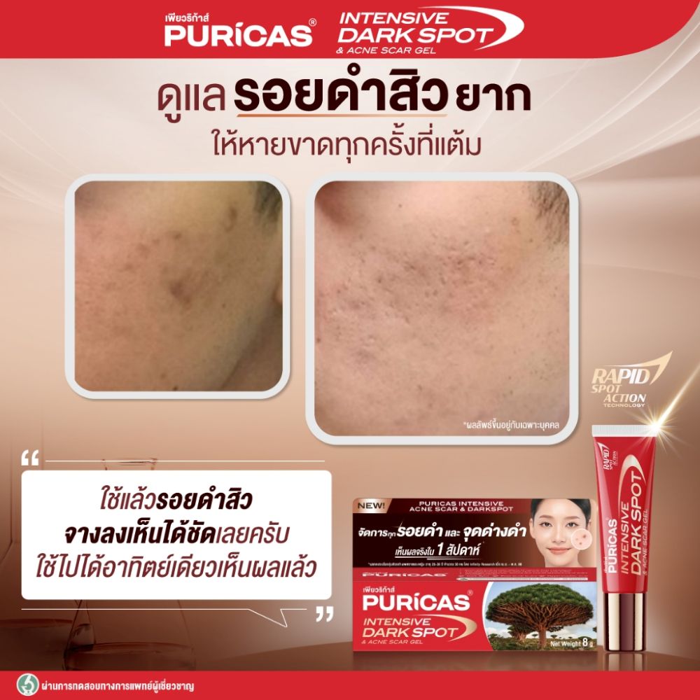Puricas Intensive Dark Spot & Acne Scar gel 8g, Puricas ราคา , Puricas รีวิว , Puricas รอยดำ , Puricas รอยสิว